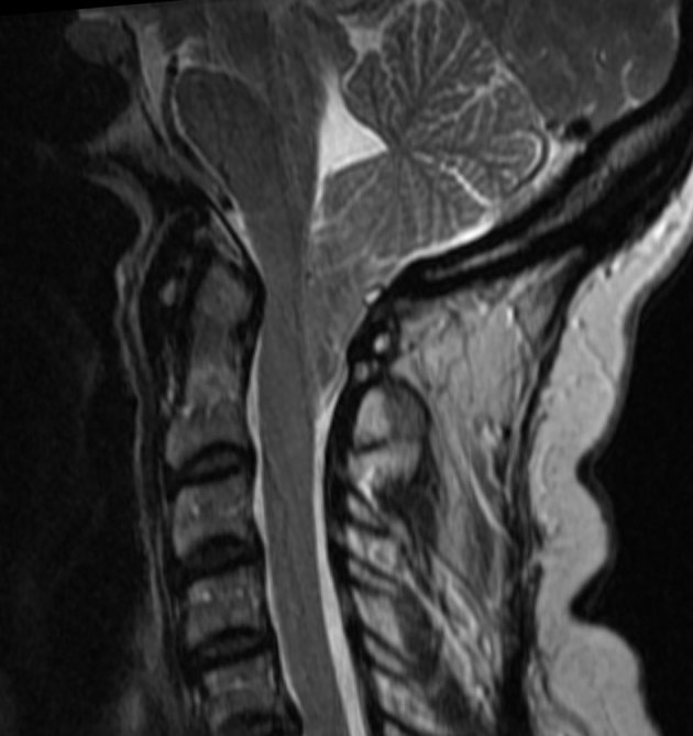 Key image 1