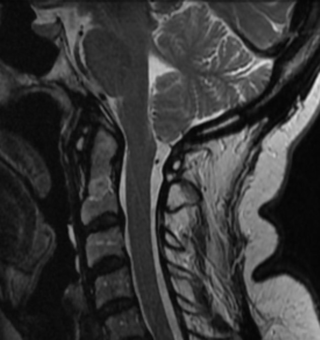 Key image 2