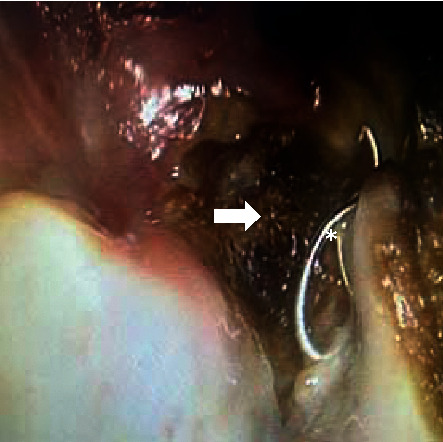 Key image 2