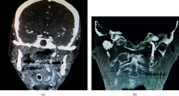 Key image 3