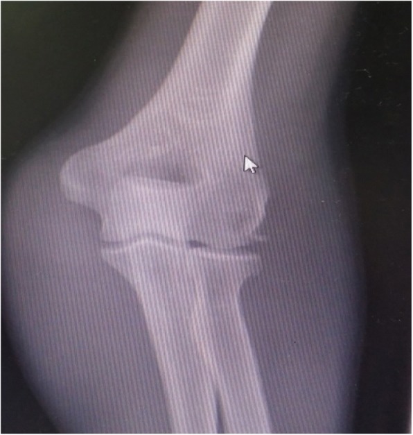 Key image 1