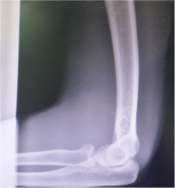 Key image 2