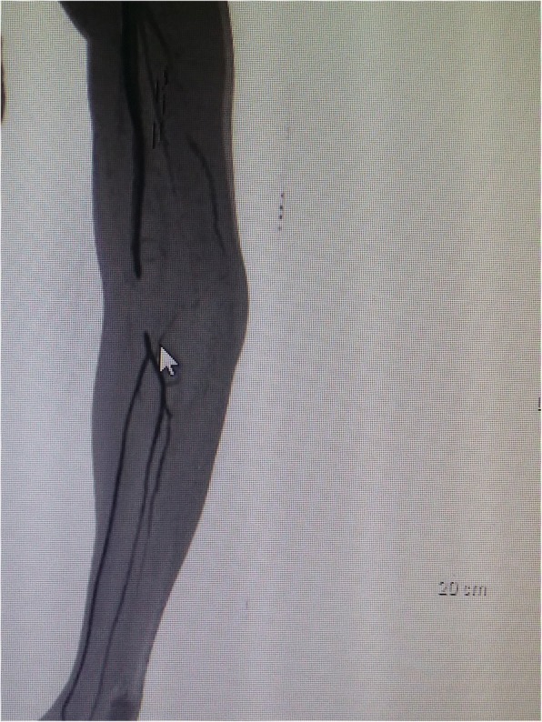 Key image 3