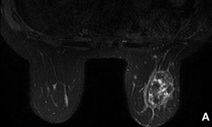 Key image 1