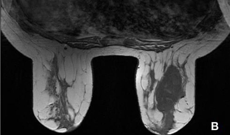 Key image 2