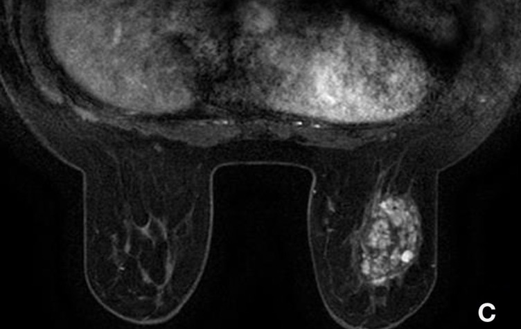 Key image 3