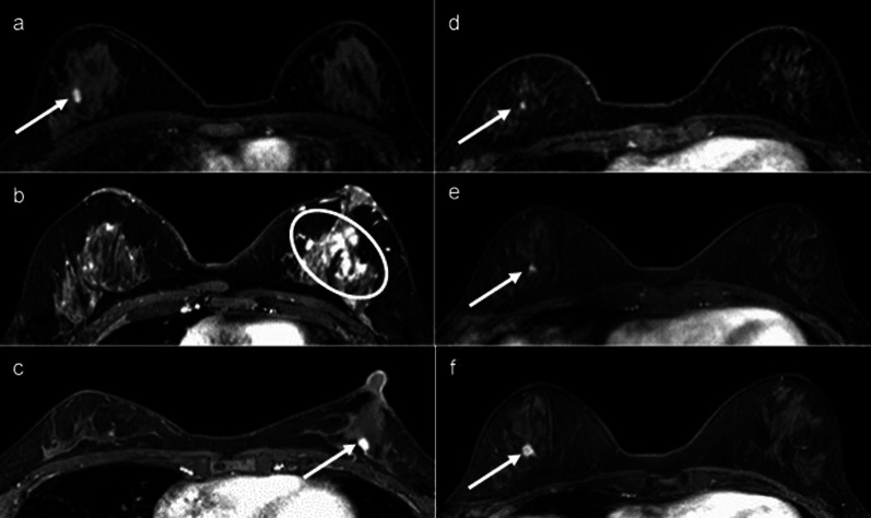 Key image 1