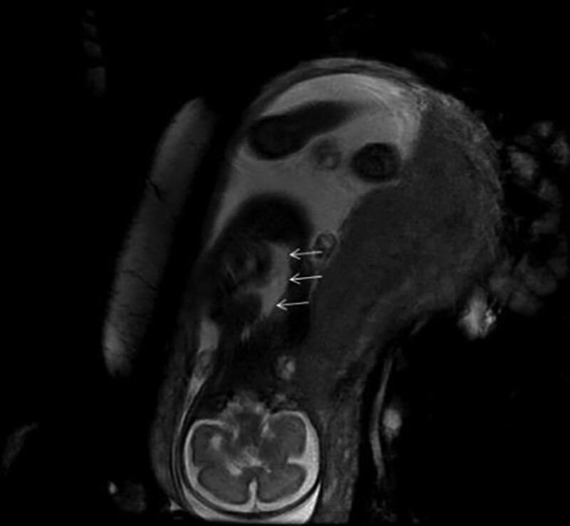 Key image 2