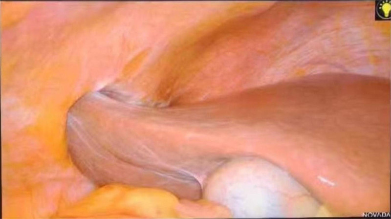 Key image 3