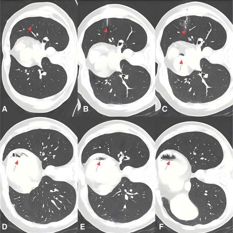 Key image 1