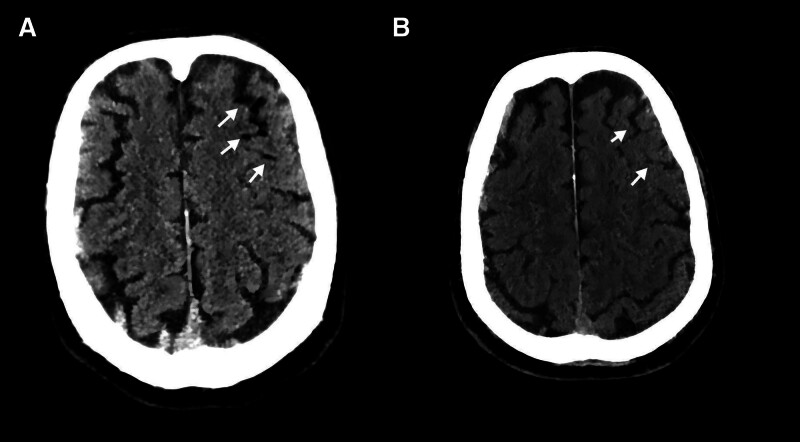 Key image 2