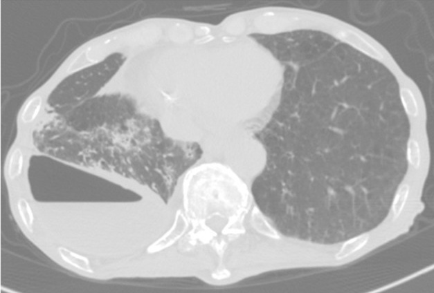 Key image 1