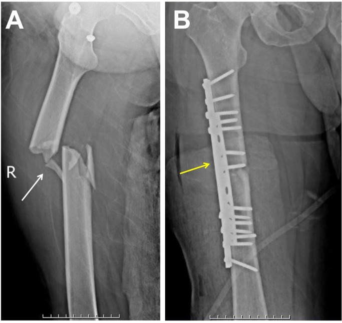 Key image 1