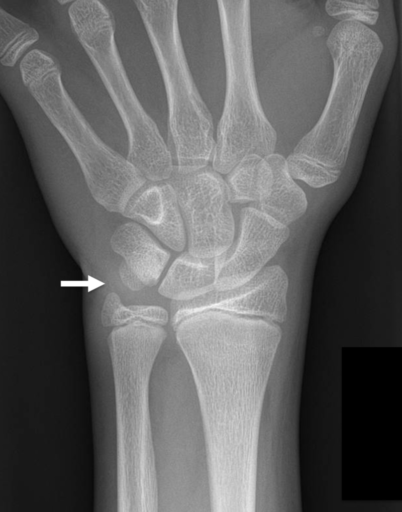 Key image 1