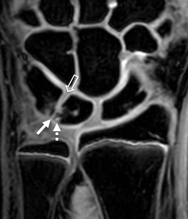 Key image 2