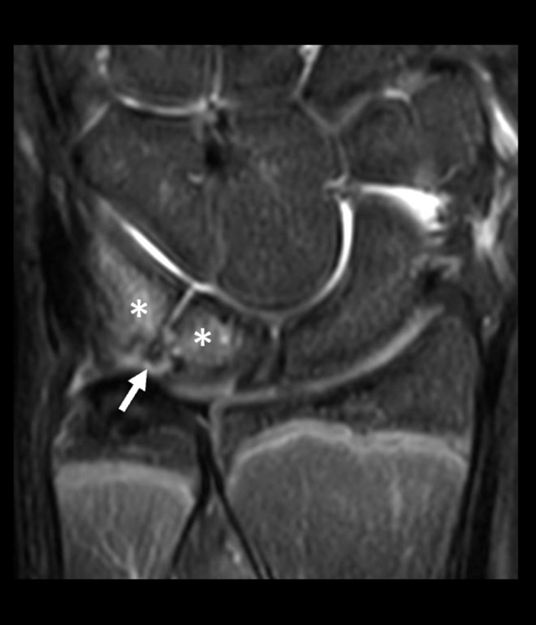 Key image 3