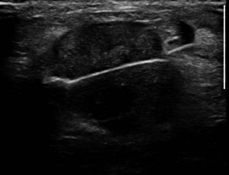 Key image 3