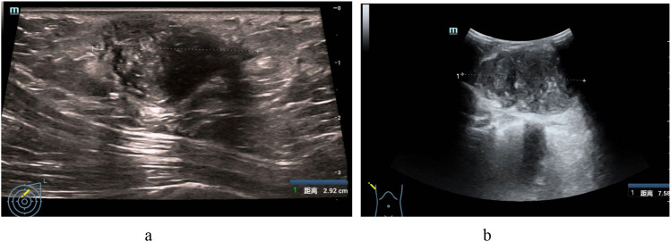 Key image 1