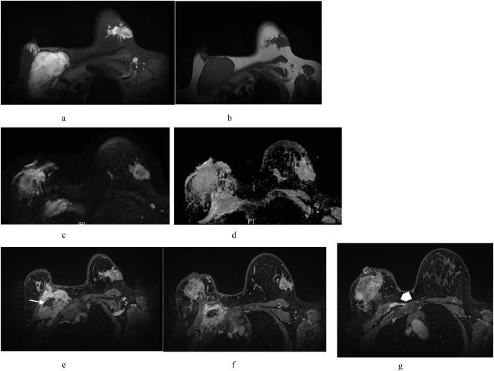 Key image 3