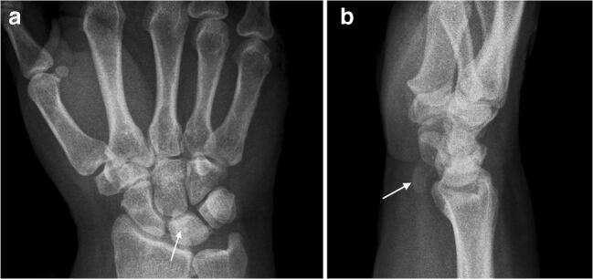 Key image 1