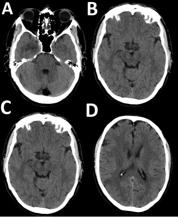 Key image 1