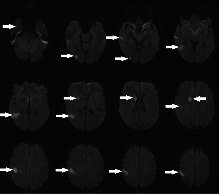 Key image 2