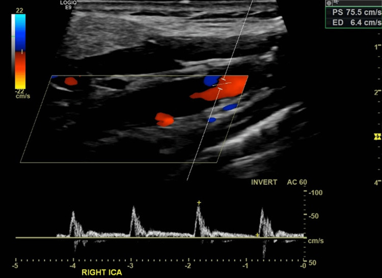 Key image 3
