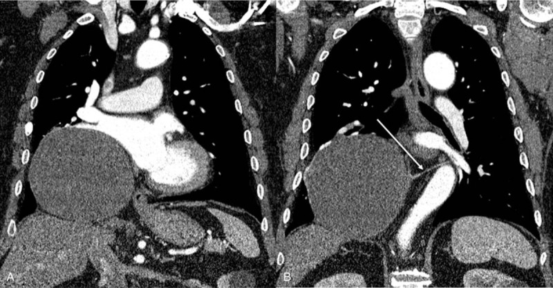 Key image 1