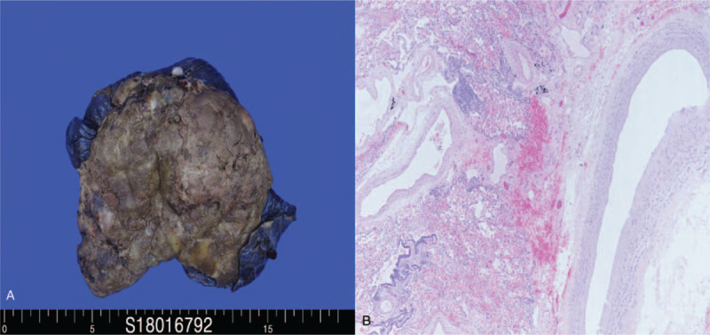 Key image 3