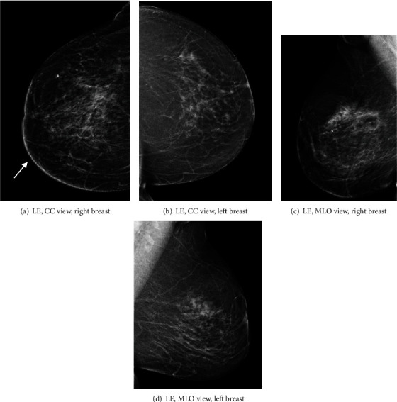 Key image 1