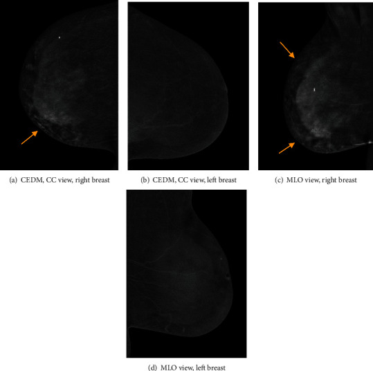Key image 3