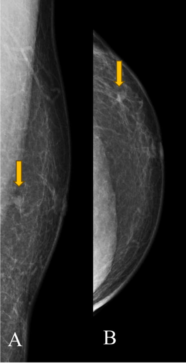 Key image 1