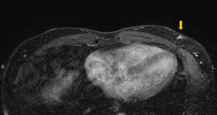 Key image 3
