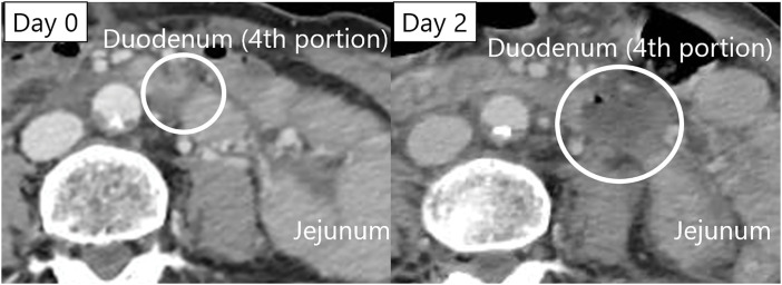Key image 1