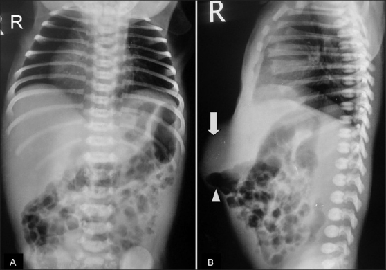 Key image 1