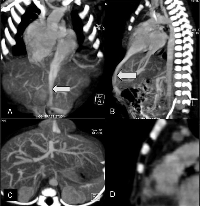 Key image 3