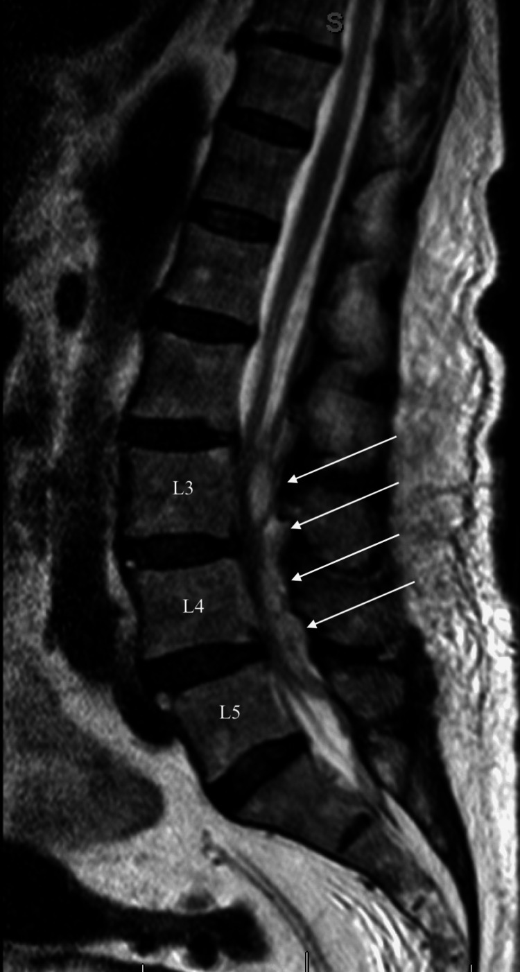 Key image 2