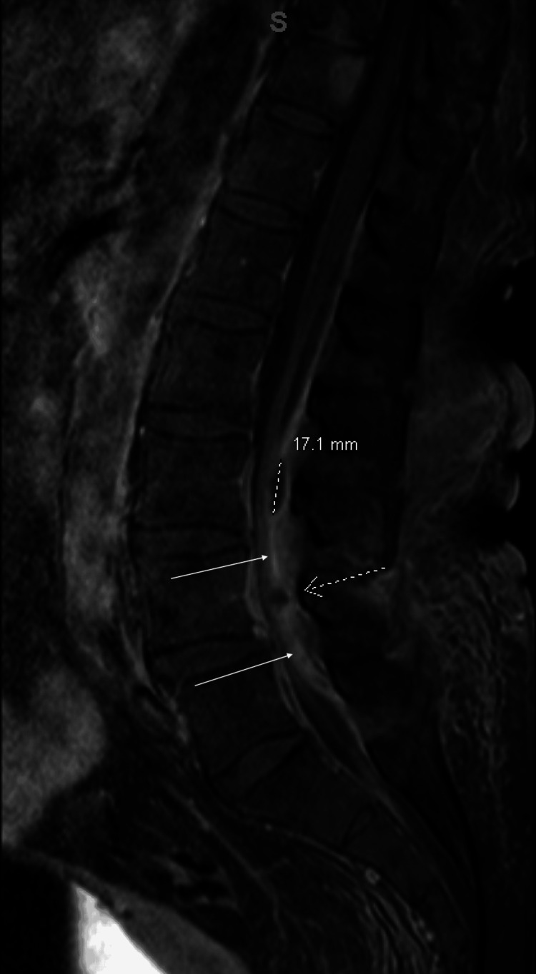 Key image 3