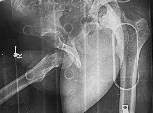 Key image 1