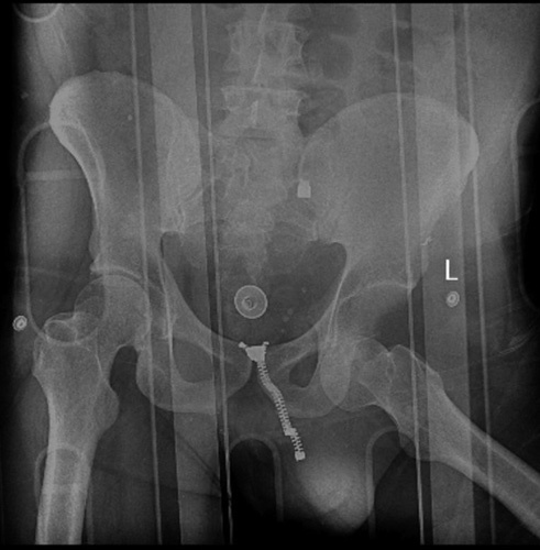 Key image 3