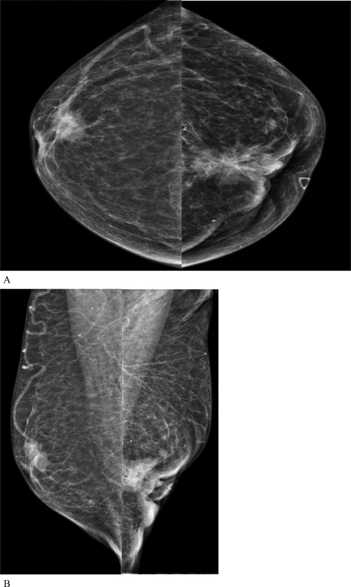 Key image 1