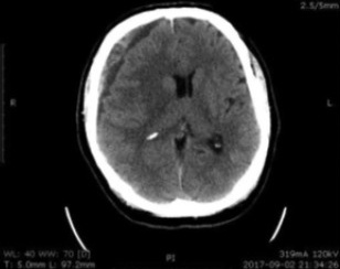 Key image 1