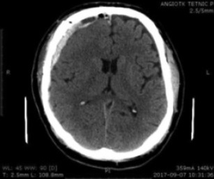 Key image 2