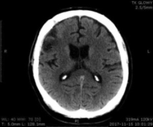 Key image 3