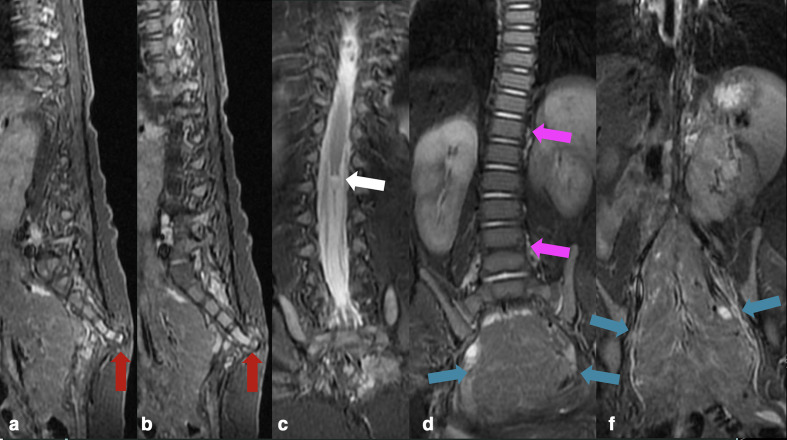 Key image 3