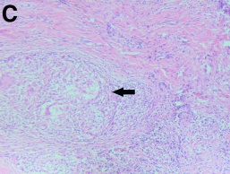 Key image 1