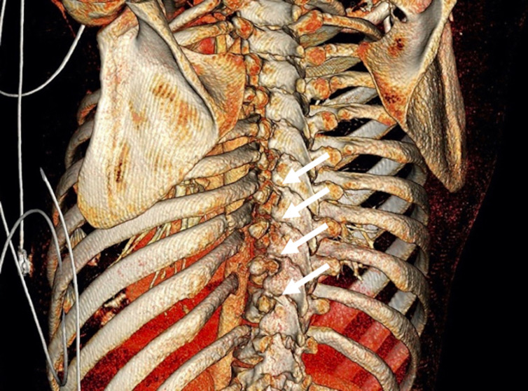 Key image 1