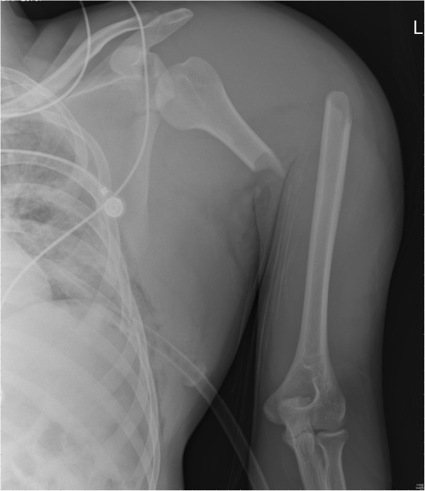 Key image 1