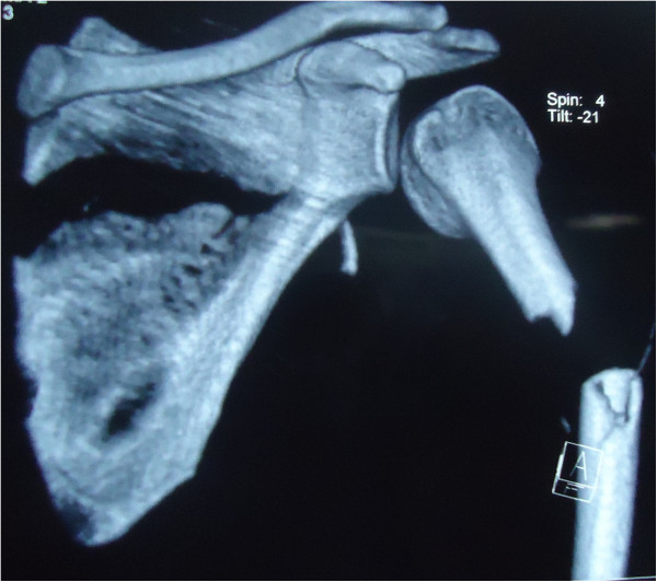 Key image 2