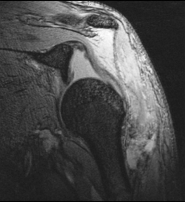 Key image 3